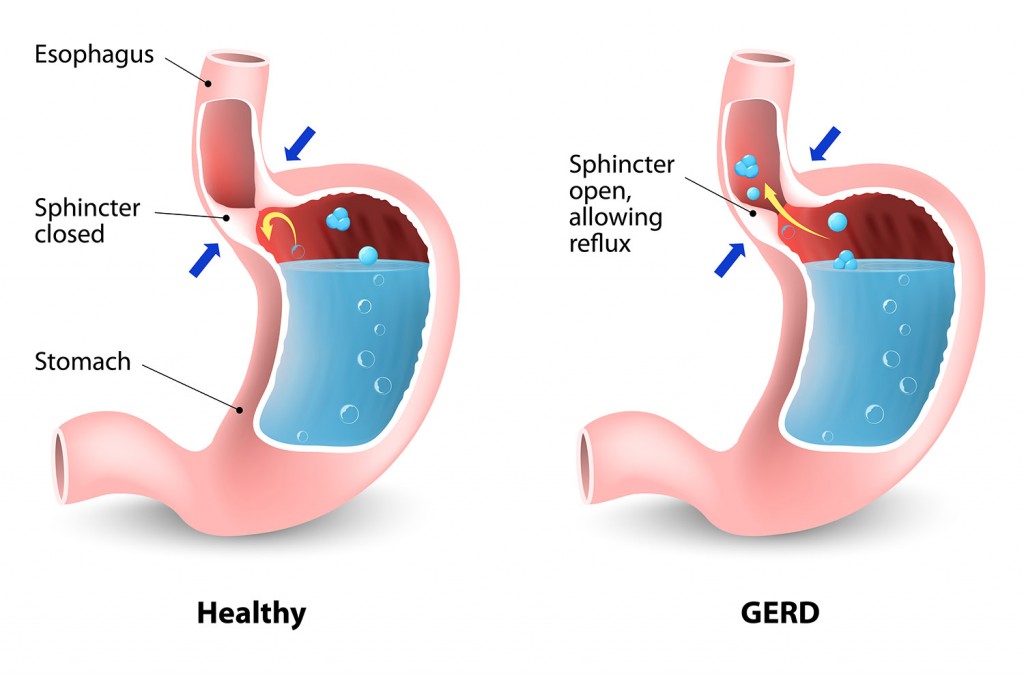 Image of the anatomy of the stomach