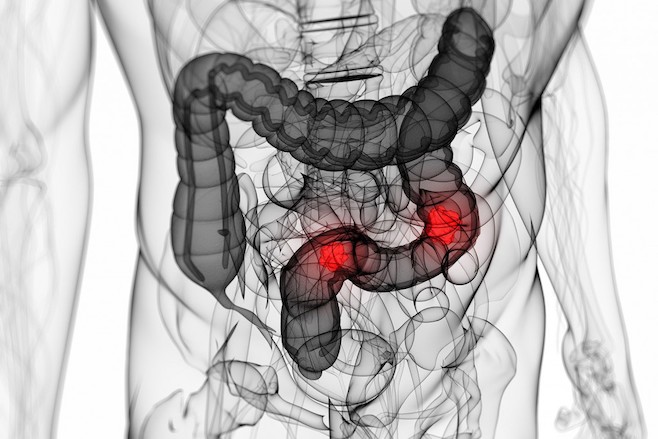 Colon - Intestinal Track